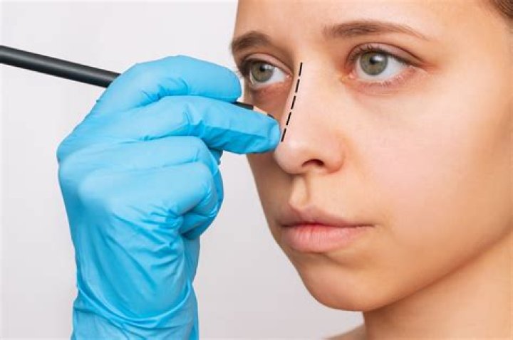 Dr. Chen Bottom Surgery: A Comprehensive Guide to Expert Care and Transformation