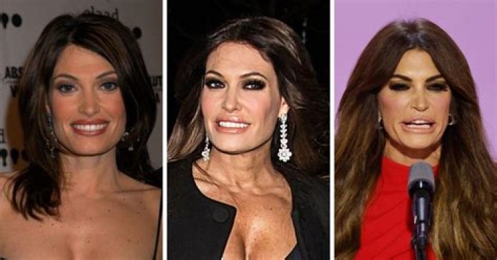 Kimberly Guilfoyle's Journey: Insights into Her Plastic Surgery Experiences