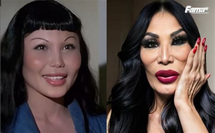 Lyn May Before and After: A Comprehensive Look at Her Transformation