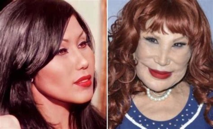 Lyn May Face Incident: The Unfolding Story Behind the Controversy