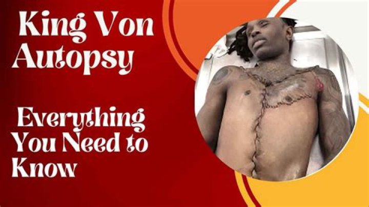 Understanding the Impact of King Von's Autopsy Pictures